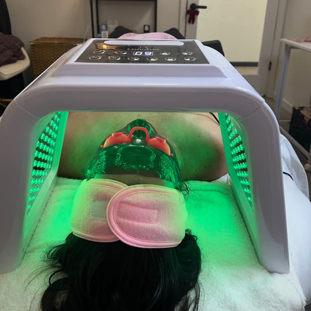 Acne Facial 10 Package at Sandra the Esti LLC in Downers Grove, IL
