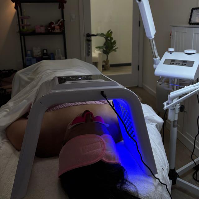 Acne Facial 5 Package 